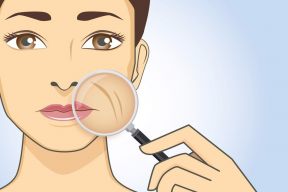 5 "tuyệt chiêu" xóa nếp nhăn khóe miệng hiệu quả