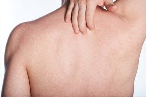 Những nguyên nhân khiến làn da của bạn bị khô sần
