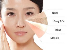 3 THÀNH PHẦN MAKEUP DỄ KHIẾN DA CHỊ EM ĐÃ KHÔ LẠI CÀNG THÊM BONG TRÓC