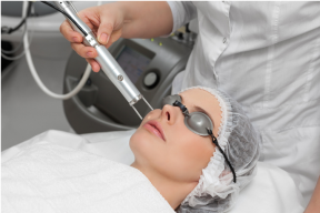 CÁCH CHĂM SÓC DA SAU KHI BẮN LASER AN TOÀN, HIỆU QUẢ