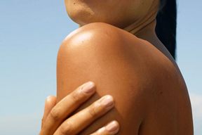 Quercetin: Thành phần chống oxy hoá và giúp chống lại các tia cực tím