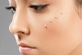 So sánh sự khác nhau giữa BB Cream và CC Cream