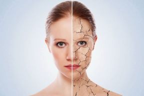 Hướng dẫn bạn cách chăm sóc da vào mùa hanh khô