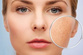 Khắc phục tình trạng da sần vỏ cam ở mặt do da khô, mất nước