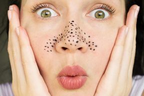 GIẢM MỤN ĐẦU ĐEN NHƯ THẾ NÀO LÀ ĐÚNG CÁCH?
