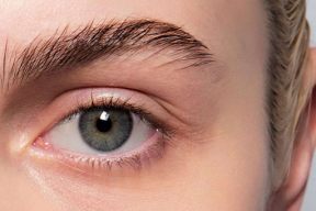 Cách trị mụn mọc ở lông mày tại nhà