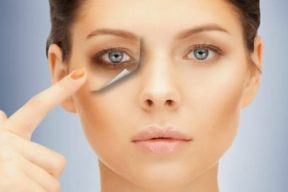 KHẮC PHỤC QUẦNG THÂM MẮT BẰNG PHƯƠNG PHÁP THIÊN NHIÊN