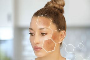 TĂNG SẮC TỐ DA: DẤU HIỆU VÀ CÁCH PHÒNG TRÁNH