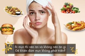 NHỮNG THỰC PHẨM KHÔNG TỐT CHO DA MỤN