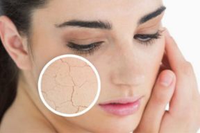 5 DẤU HIỆU CẢNH BÁO LÃO HOÁ DA ĐANG ĐẾN