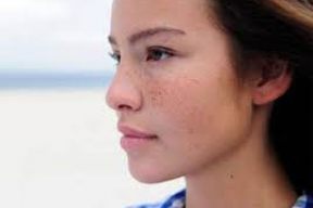 9 cách đánh bật mụn ẩn ra khỏi làn da của bạn