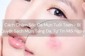 Cách Chăm Sóc Da Mụn Tuổi Teen - Bí Quyết Sạch Mụn, Sáng Da, Tự Tin Mỗi Ngày