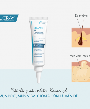 Kem Dưỡng DUCRAY Giúp Làm Giảm Mụn, Mờ Vết Thâm 30ml