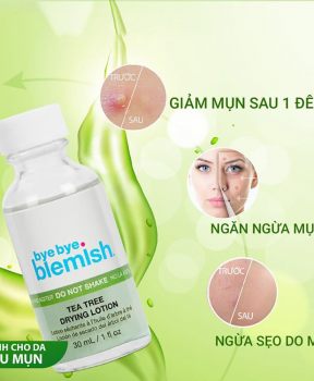 Bye bye Blemish Chấm mụn Tea Tree Drying Lotion 30ml